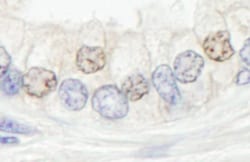 XPF Antibody, Novus Biologicals 0.1mL; Unlabeled:Antibodies, Polyclonal